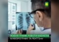 У Бучі оновили графік роботи флюорографії та рентгену