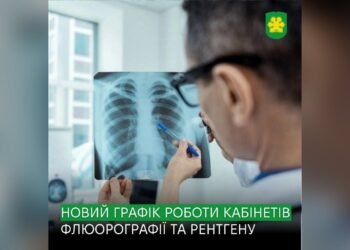 У Бучі оновили графік роботи флюорографії та рентгену