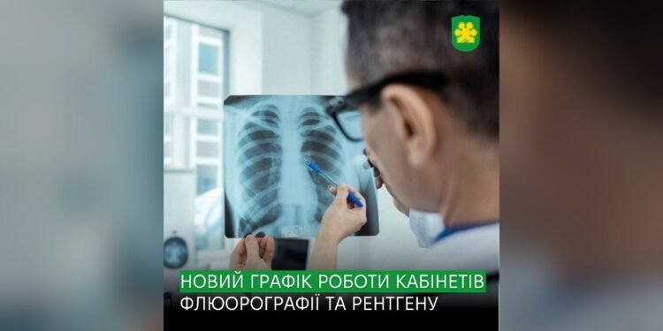У Бучі оновили графік роботи флюорографії та рентгену